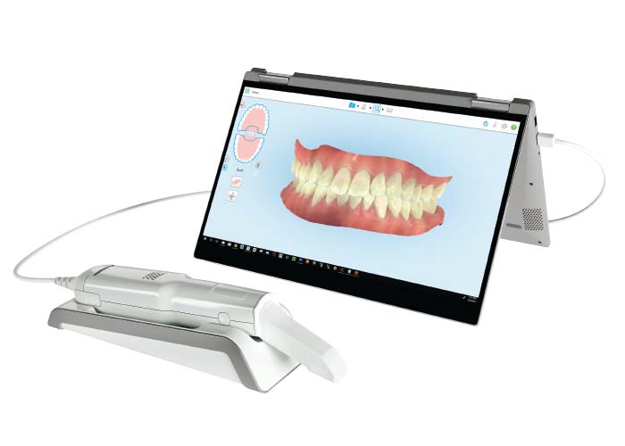 Digital X-Ray